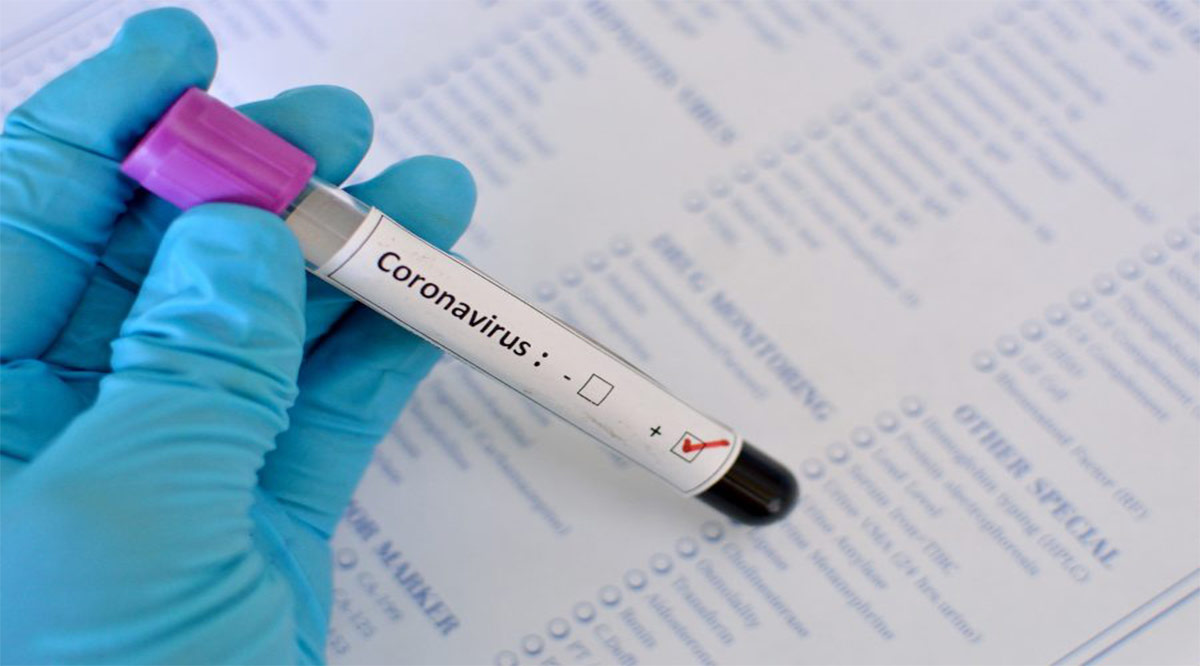 Confirman 89 casos positivos de Covid-19 y un deceso; llega BCS a 726 y 615