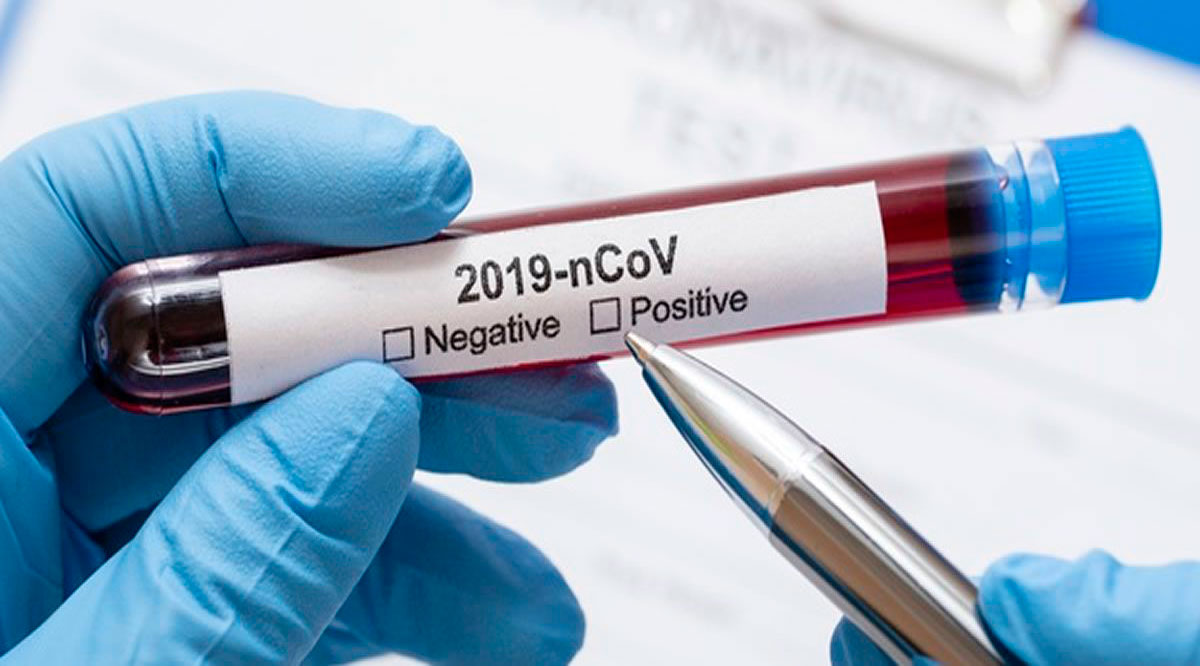 Confirman 73 casos positivos de Covid-19 y 3 decesos; llega BCS a 683 y 636