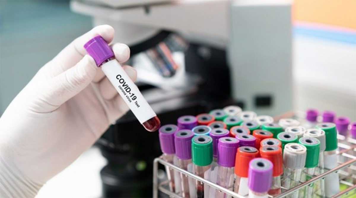Se avecina aumento de contagios de Covid en BCS