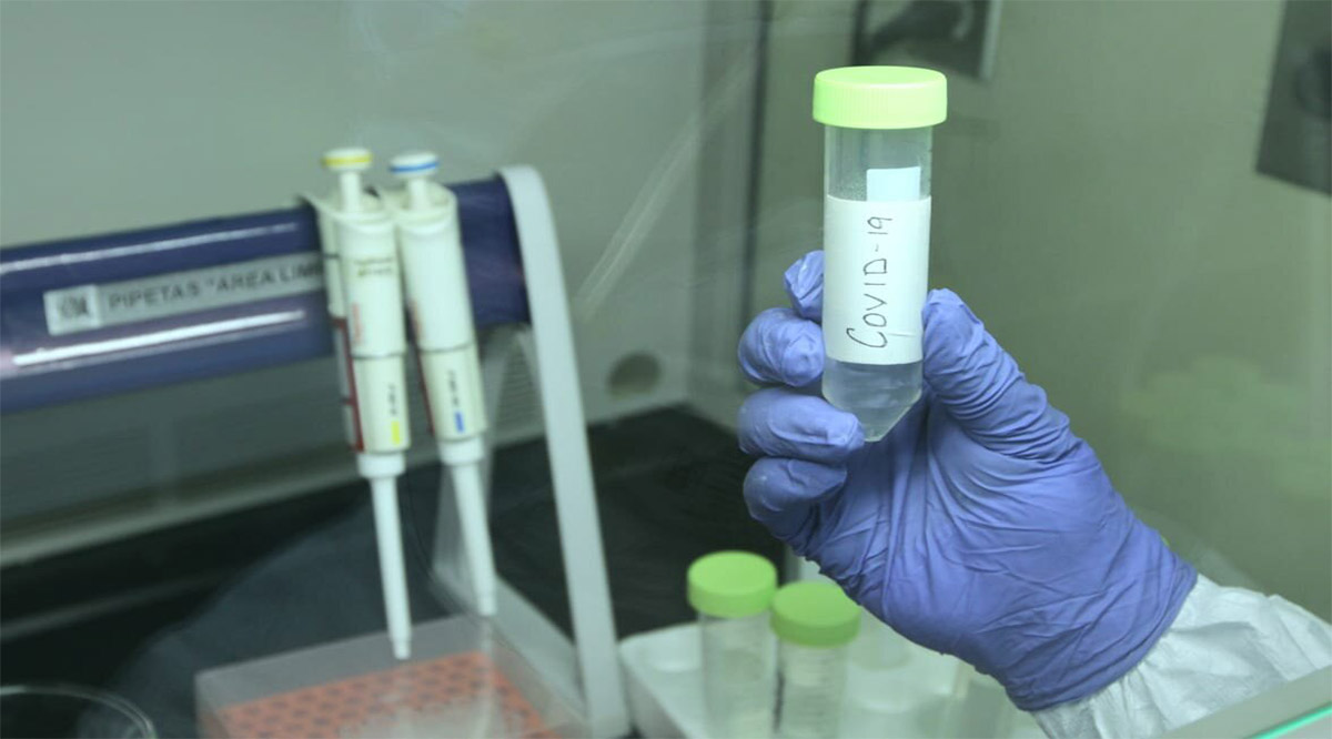 Supera BCS los 12 mil casos recuperados y 670 defunciones por Covid-19