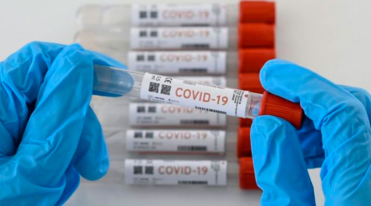 Confirman 91 casos positivos de Covid-19 y no hubo decesos; llega BCS a 730 y 731