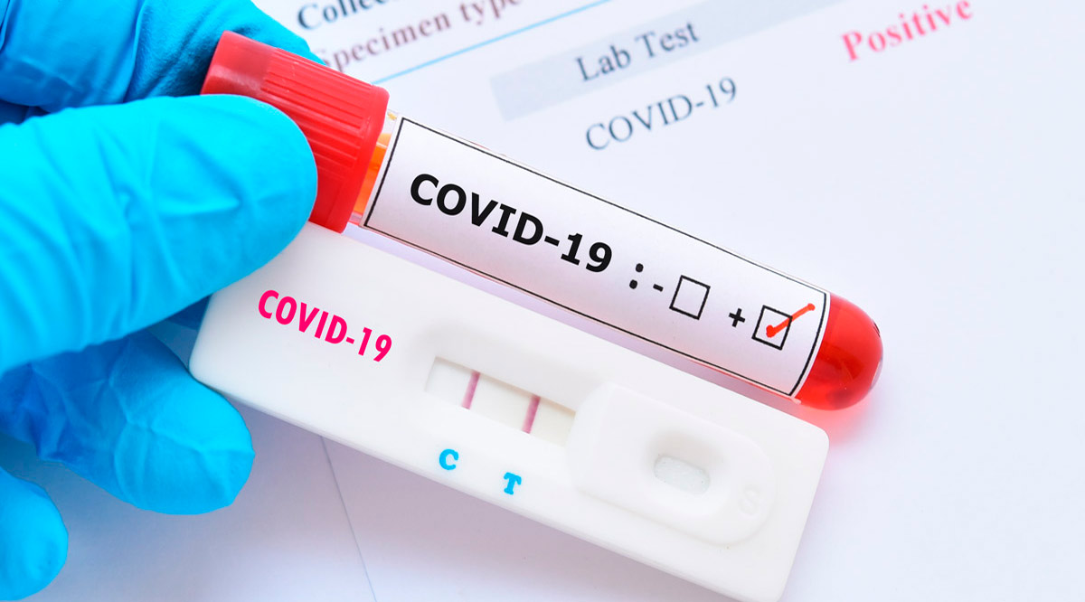 Confirman 97 casos positivos de Covid-19 y 2 decesos; llega BCS a 663 y 721 Confirman 97 casos positivos de Covid-19 y 2 decesos; llega BCS a 663 y 721