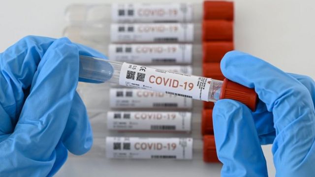 Confirman 122 casos positivos de Covid-19 y no hubo decesos; llega BCS a 646 y 715