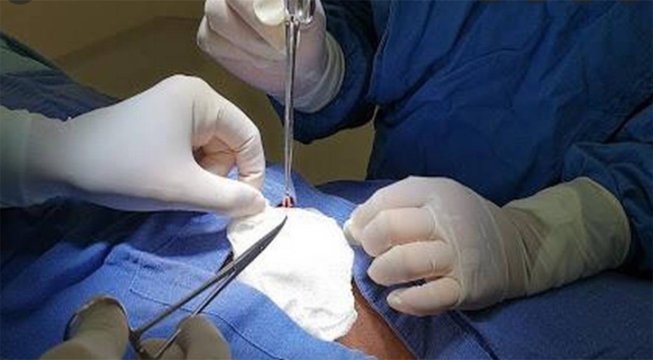 Realiza IMSS de BCS jornada de vasectomía sin bisturí