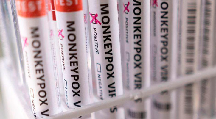 Está preparado BCS para enfrentar la viruela del mono; no se han reportado casos