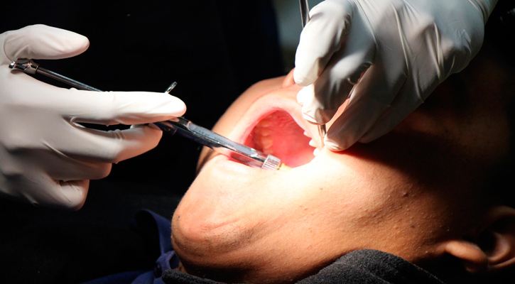 Recomienda IMSS mantener buena higiene bucal