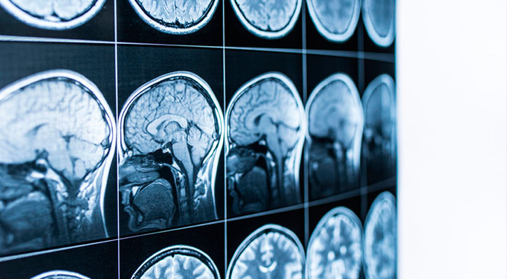 Beneficiará gobierno de Los Cabos a 40 personas con valoraciones neuropediátricas