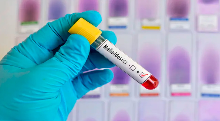 Un misterio para la SSA presencia de bacteria causante de melioidiosis en La Paz