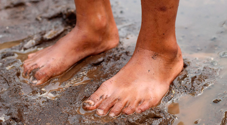 Próximas lluvias en BCS podrían activar la bacteria de la melioidosis, advierte SSA