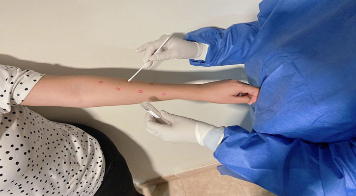 Confirma SSA un caso de viruela símica no grave en Los Cabos Confirma SSA un caso de viruela símica no grave en Los Cabos