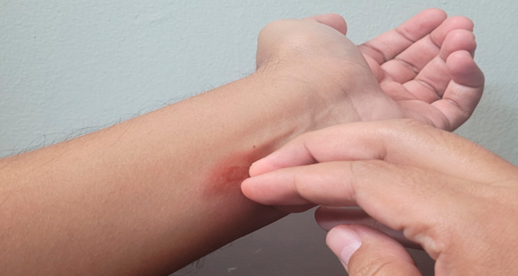 Llama IMSS a protegerse de picadura de moscos para prevenir dengue Llama IMSS a protegerse de picadura de moscos para prevenir dengue