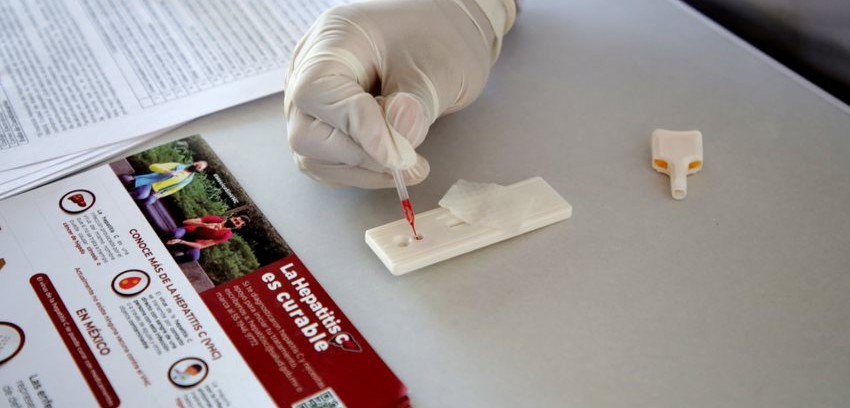 Llama IMSS a reforzar medidas de prevención y detección oportuna contra la hepatitis en BCS